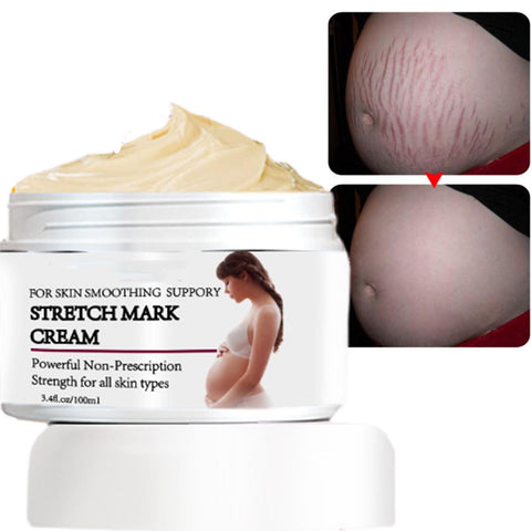 Rosarden Stretch Mark Prevention Cream for Pregnancy, Stretch Mark Cream Remover, Stretch Mark Lotion for Pregnancy, Tummy Butter for Stretch Marks Pregnancy, Shea Butter Stretch Mark Removal Cream Rosarden Stretch Mark Prevention Cream for Pregnancy, Stretch Mark Cream Remover, Stretch Mark Lotion for Pregnancy, Tummy Butter for Stretch Marks Pregnancy, Shea Butter Stretch Mark Removal Cream