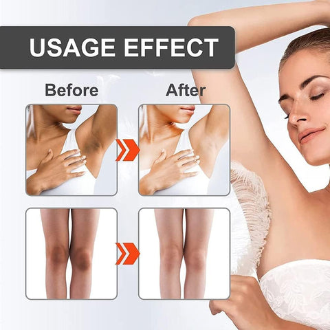 3PCS Snow Bleach Cream for Sark Spot Remover , Intimate Areas-Underarm, Neck, Armpit, Knees, Elbows,Face,Body 3PCS Snow Bleach Cream for Sark Spot Remover , Intimate Areas-Underarm, Neck, Armpit, Knees, Elbows,Face,Body