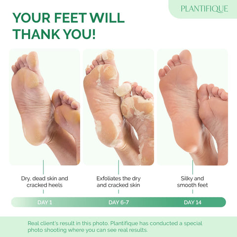Plantifique Foot Peel Mask with Peach 2 Pack Foot Mask Dermatologically Tested - Repair Heels & Removes Dry Dead Skin for Soft Baby Feet - Exfoliating Foot Peel Mask for Hard Skin - Peeling