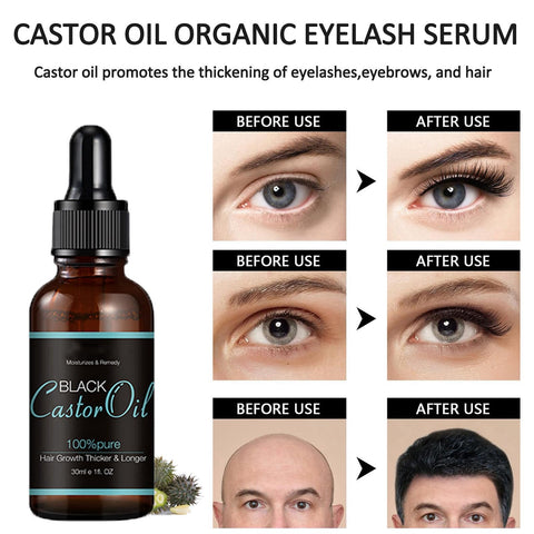 Castor Oil Organic Eyelash Serum, Lash Growth Serum, Castor Oil For Eyelashes, Eyebrows And Hair Growth, 100% Pure Organic Castor Oil For Eyelashes, Eyebrows, Hair & Skin Care - 30 ml Castor Oil Organic Eyelash Serum, Lash Growth Serum, Castor Oil For Eyelashes, Eyebrows And Hair Growth, 100% Pure Organic Castor Oil For Eyelashes, Eyebrows, Hair & Skin Care - 30 ml