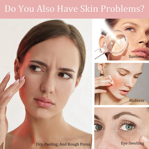 Face Ice Roller, Ice Roller For Face, Ice Roller, Skin Care Face Ice Roller, Ice Face Roller, Safe And Reusable Face Ice Roller, Ice Roller For Face, Ice Roller, Skin Care Face Ice Roller, Ice Face Roller, Safe And Reusable