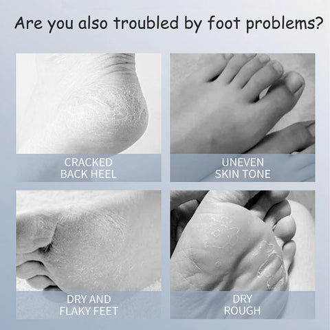 Foot Mask, Moisturizing Foot Peel Mask with Goat Milk and Niacinamide, Hydrating Mask Socks for Dry Cracked Feet Care, 3 Pack of Regular Size Exfoliating Foot Masks for Dry and Cracked Heels Foot Mask, Moisturizing Foot Peel Mask with Goat Milk and Niacinamide, Hydrating Mask Socks for Dry Cracked Feet Care, 3 Pack of Regular Size Exfoliating Foot Masks for Dry and Cracked Heels