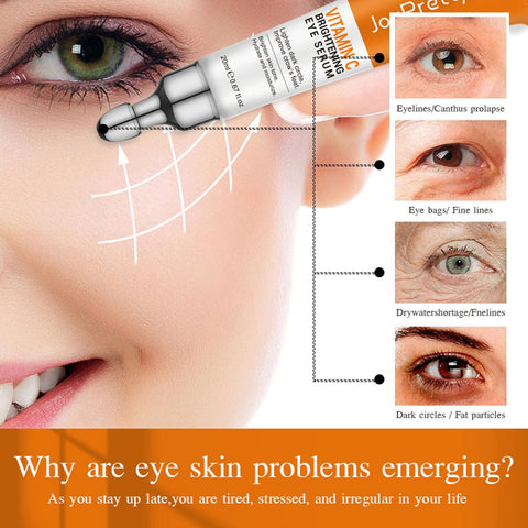 Eye Cream For Dark Circles, Vitamin C Eye Cream For Dark Circles And Puffiness, Anti Aging Eye Cream For Reduce Fine Lines, Wrinkles, & Dark Circles, Under Eye Cream For Puffiness And Bags (01) Eye Cream For Dark Circles, Vitamin C Eye Cream For Dark Circles And Puffiness, Anti Aging Eye Cream For Reduce Fine Lines, Wrinkles, & Dark Circles, Under Eye Cream For Puffiness And Bags (01)