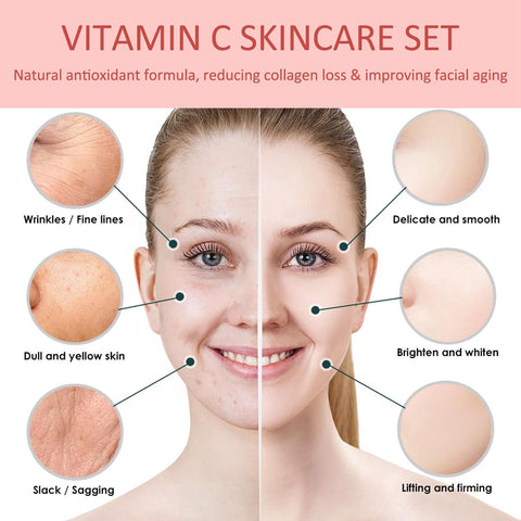 Rosarden Vitamin C Skin Care Set, 3-In-1 Skincare Gift Set With Facial Cleanser Mousse, Face Serum & Face Cream, Anti-Aging Skin Care Kit With Hyaluronic Acid, Vitamin E, Vitamin C & Niacinamide 3PCS Rosarden Vitamin C Skin Care Set, 3-In-1 Skincare Gift Set With Facial Cleanser Mousse, Face Serum & Face Cream, Anti-Aging Skin Care Kit With Hyaluronic Acid, Vitamin E, Vitamin C & Niacinamide 3PCS