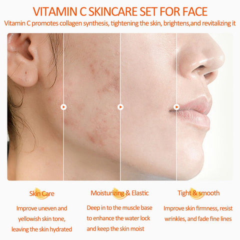 Vitamin C Skincare Set, 5-In-1 Skincare Gift Set With Cleanser, Toner, Face Serum, Face Cream, And Eye Cream, Skin Care Products For Teen Girls, Long-Lasting Moisturizing Skincare Set For Women Men Vitamin C Skincare Set, 5-In-1 Skincare Gift Set With Cleanser, Toner, Face Serum, Face Cream, And Eye Cream, Skin Care Products For Teen Girls, Long-Lasting Moisturizing Skincare Set For Women Men