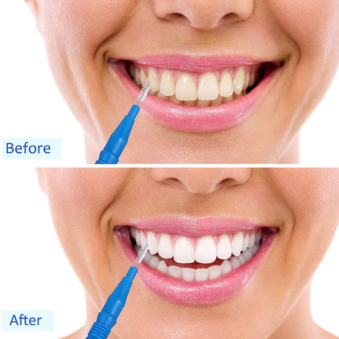 Cmzxc Interdental Brush,Toothpick Tooth Flossing Head Oral Dental Hygiene Brush, Tooth Cleaning Tool(50 Count) Cmzxc Interdental Brush,Toothpick Tooth Flossing Head Oral Dental Hygiene Brush, Tooth Cleaning Tool(50 Count)