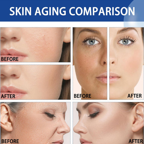 Rosarden Hyaluronic Acid and Niacinamide Serum, Hydrating Vitamin B3 Facial Moisturizer, Skin Pore Serum for Glowing, Anti-Aging Face Serum for Women Rosarden Hyaluronic Acid and Niacinamide Serum, Hydrating Vitamin B3 Facial Moisturizer, Skin Pore Serum for Glowing, Anti-Aging Face Serum for Women