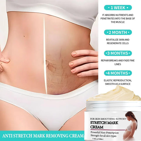Rosarden Stretch Mark Prevention Cream for Pregnancy, Stretch Mark Cream Remover, Stretch Mark Lotion for Pregnancy, Tummy Butter for Stretch Marks Pregnancy, Shea Butter Stretch Mark Removal Cream Rosarden Stretch Mark Prevention Cream for Pregnancy, Stretch Mark Cream Remover, Stretch Mark Lotion for Pregnancy, Tummy Butter for Stretch Marks Pregnancy, Shea Butter Stretch Mark Removal Cream