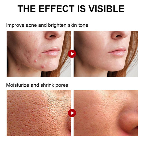 Rosarden 77% Soothing Toner, Face Toner for Women, Skin Toner, Toner for Face, Toner for Dry Skin, Refreshing, Exfoliating, Purifying, Cruelty Free Rosarden 77% Soothing Toner, Face Toner for Women, Skin Toner, Toner for Face, Toner for Dry Skin, Refreshing, Exfoliating, Purifying, Cruelty Free