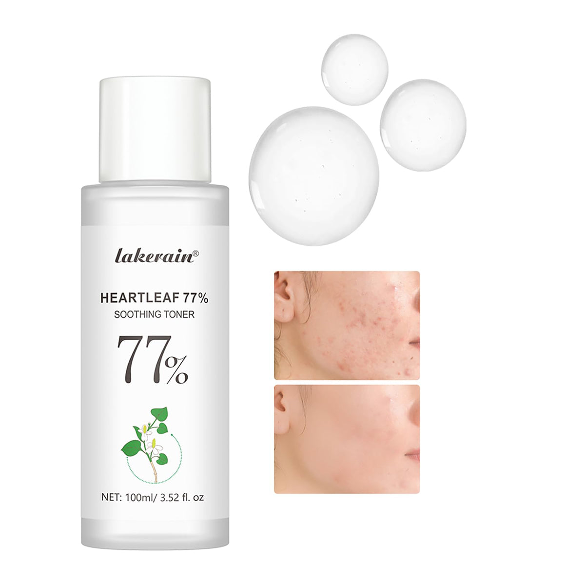 Easilydays Heartleaf 77% Soothing Toner, Deeply Moisture and Oil Balance, Balancing Oil, with Houttuynia Cordata Extract, Repairs, Calming Skin and Hydrating Heartleaf Facial Toner