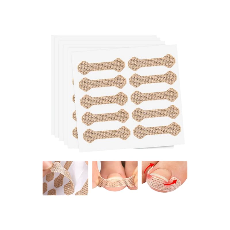 Ingrown Toenail Treatment: 120Pcs Breathable Ingrown Toenail Corrector Strips - Painless Ingrown Toenail Tool for Professional Pedicure and Toenail Correction