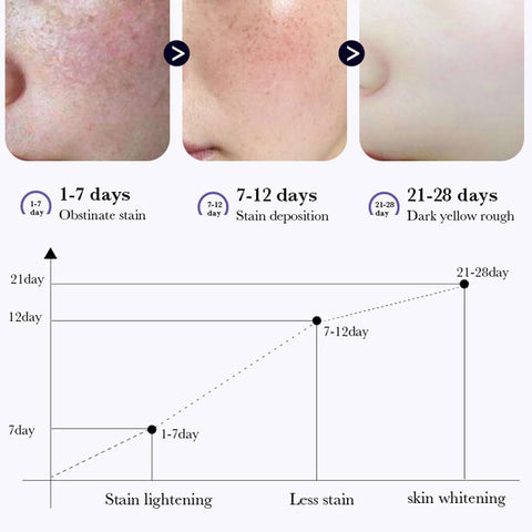 paminify Dark Spot Remover for Face,Nicotinamide Whitening Freckle Cream,Skin Dullness Lightening Body Cream,Visible Results in 28 Days,Smooth Melasma,Hyperpigmentation Age Dark Spot Corrector,0.7 oz