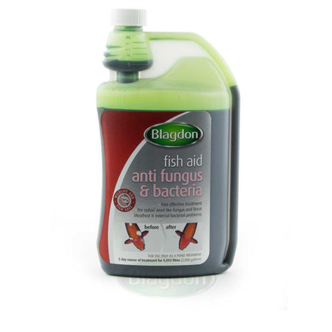 Blagdon Fast Acting Anti-Fungus & Bacteria Water Treatment for All Pond Fish, Finrot, Mouthrot, External Bacterial Infections, Wildlife & Fish Safe, 1 Litre