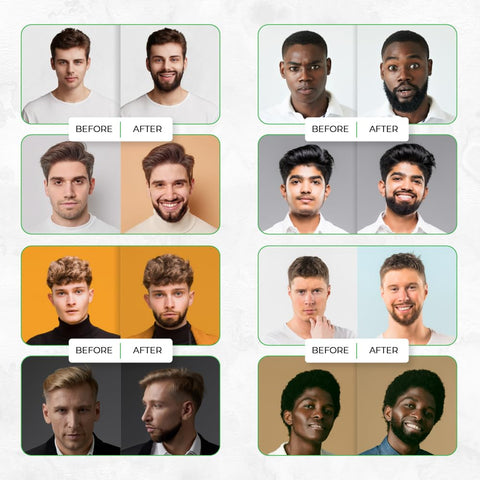 ABERA Ginb Pro Strengthens Growth Beard & Eyebrows Serum For Men, Organic Castor Oil & Acetyl tetrapeptide-3 Extra to promote and soften a full thickening Beard, Vitamins, Biotin & Nature 0.67 fl OZ