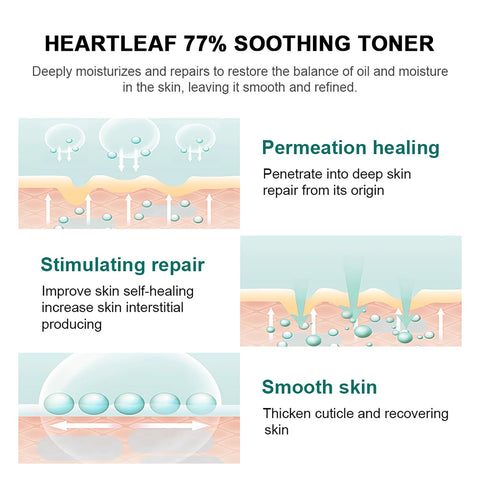 Easilydays Heartleaf 77% Soothing Toner, Deeply Moisture and Oil Balance, Balancing Oil, with Houttuynia Cordata Extract, Repairs, Calming Skin and Hydrating Heartleaf Facial Toner