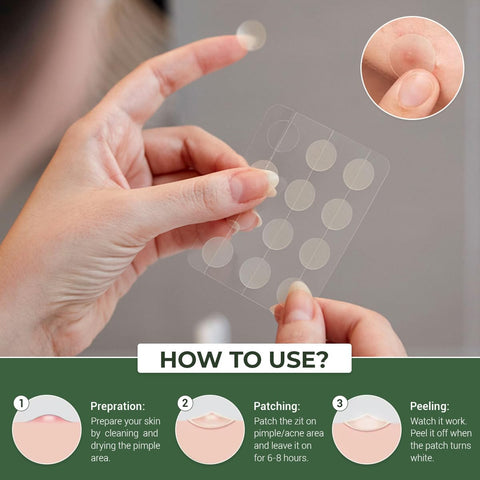 Generic ALMAZ SKINCARE Invisible Spot Cover - Hydrocolloid Acne Patch for Face, Blemishes, Zits Absorbing Patch, Breakouts Spot Treatment for Skin Care, Facial Sticker, (32 Count)