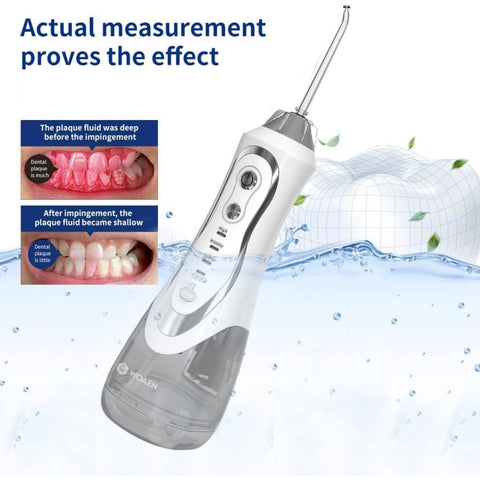 Generic WOAEN Water Dental Flosser Teeth Pick Oral Irrigator Portable Rechargeable Teeth Cleaner, 300ML Water Reservoir, IPX7 Waterproof, 3 Modes, White