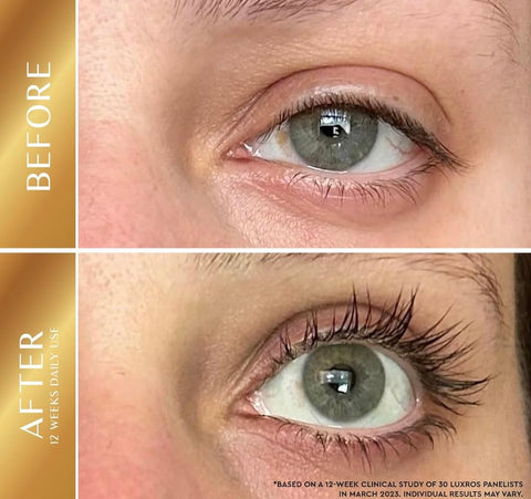Eyelash Growth Serum Ultra-Lash-MD Get Thick, Strong Lashes in Just 3-4 Weeks with Our Plant-Based Eyelash Growth Serum Amazing Lashes In Weeks 100% Works Cruelty Free Irritation Free