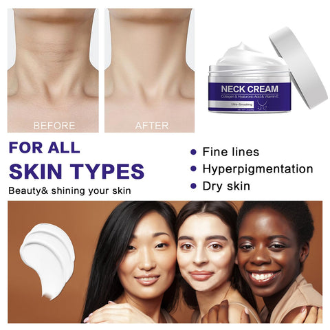 Neck Firming Cream - Neck Cream - Neck Firming Cream Tightening Lifting Sagging Skin - Aging Skin & Saggy Skin - Anti Aging Neck Cream - Reduce Wrinkles & Smoothing Neck Fine LIines - Neck&Body