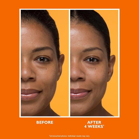 Peter Thomas Roth | Potent-C Brightening Vitamin C Moisturizer, For Dullness, Uneven Skin Tone, Dark Spots and Wrinkles, Antioxidant Moisturizer