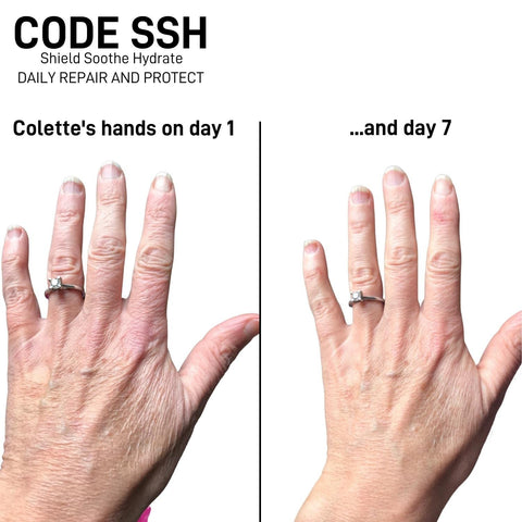 CODE Beautiful Hand Cream to Protect, Restore & Renew skin, For all skin, Hand Cream for Very Dry Hands, Barrier Cream for hands, Feet & Elbows, Cruelty Free & Vegan SSH Shield Soothe Hydrate 30ml