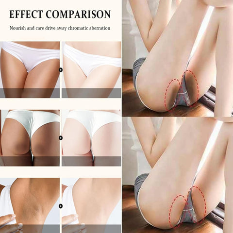 Crema Blanqueadora para Partes Intimas, Crema para Las Manchas de La Cara, Crema para Aclarar las Axilas Y Partes Intimas, Leche Con Colageno Crema Aclarante, 30 ml / 1.0 Fl Oz