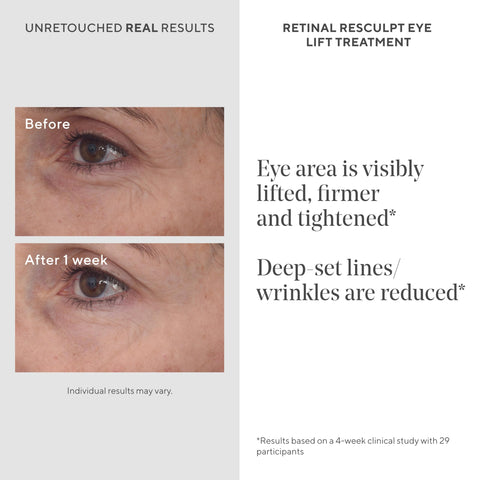 Murad Retinal ReSculpt Eye Lift Treatment - Resurgence Anti-Aging Eye Cream Lifts and Improves Sagging - Encapsulated Vitamin A Skin Care Firms Droopy Eyelids, Reduces Lines and Wrinkles - 0.5 FL OZ