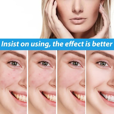 Crema para Manchas Oscuras en La Cara, Cremas para Quitar Manchas de La Cara, Crema para Manchas en La Cara, Crema para Las Manchas de La Cara, 20g/0.71Fl Oz