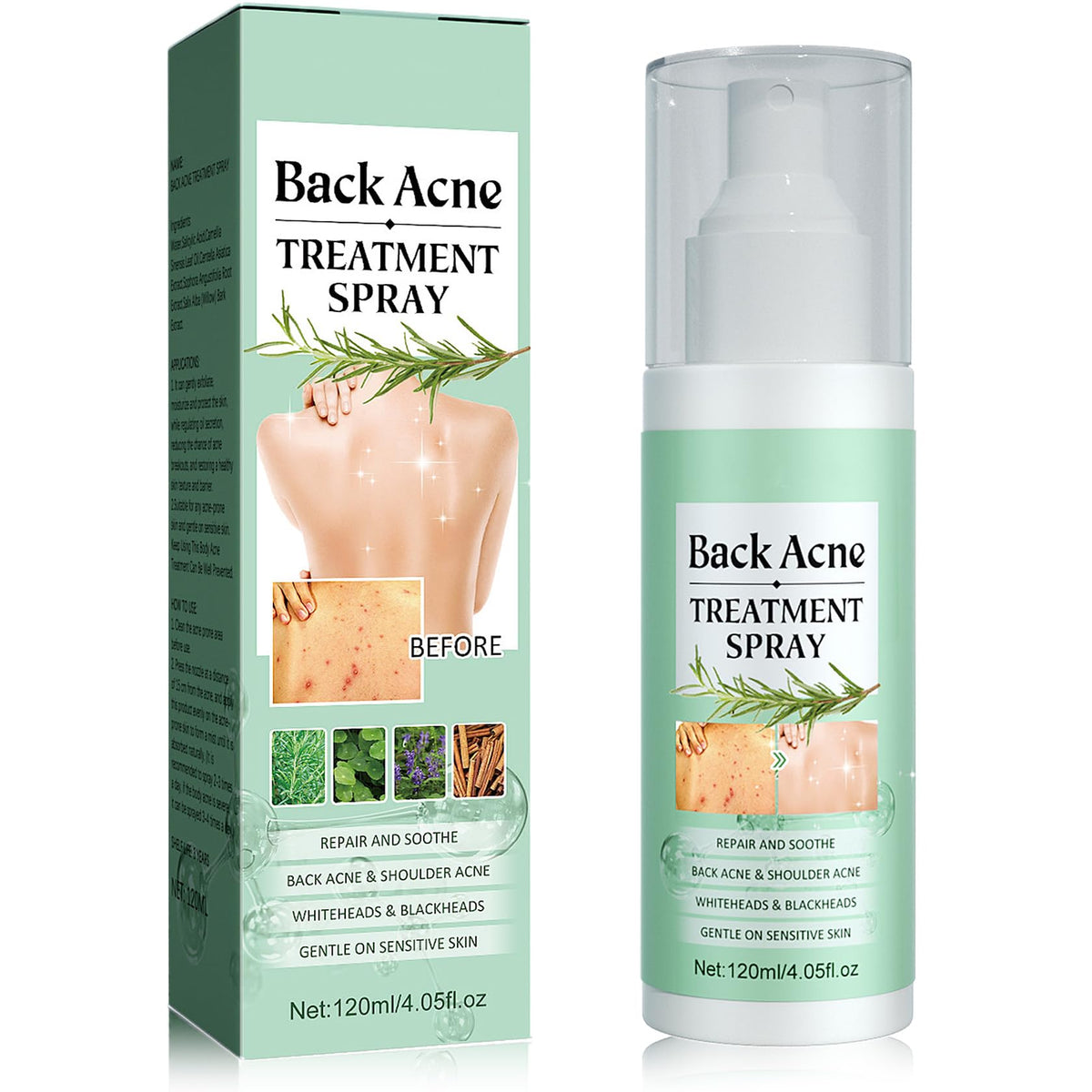 Back Acne Treatment,Back Acne Spray with Salicylic & Tea Leaf Oil Formula,Salicylic Acid Spray,Acne Body Spray Bacne Spray Natural Acne Treatment,Acne Spray for Back and Body