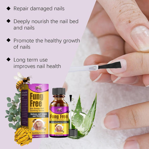 Flysmus Bee Venom Nail Treatment Serum,Natural Bee Venom Nail Serum,Ingrown Toenail Treatment Drop,Nail Growth and Repair Serum (1pcs)