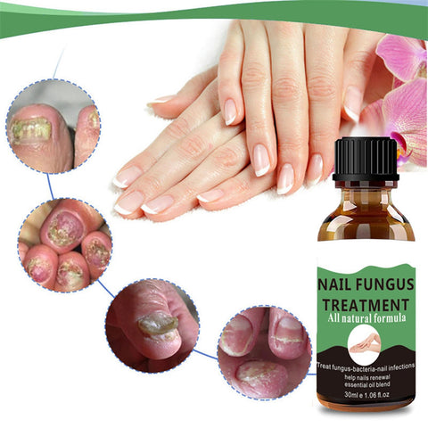 Fungal Nail Treatment - Extra Strong Nail Fungus Treatment for Toenail and Fingernail - Anti fungus Nail Repair and Strengthen, Fix & Renew Damaged, Broken Nails