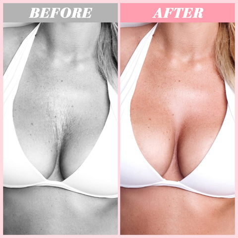 Chest Wrinkle Pad Reusable Silicone Chest Pad Transparent Silicone Wrinkle Patch Overnight Cleavage Decollete Patch Smooth The Skin Silicone Pad for Women Girls Skin Makeup Accessories, 5.9 x 4.7 Inch