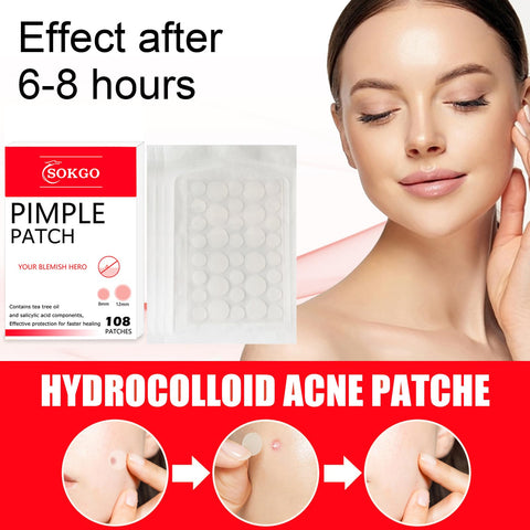 Pimple Patch, Acne Patch, Acne Spot Dots, Pore Cleansing Strips, Hydrocolloid Acne Pimple Patch For Covering Zits, Blemishes, Dark Spots, Post-Blemish Redness, Hyper pigmentation (72PCS)