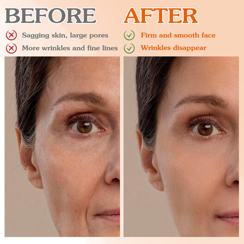 2Rolls Facial Myofascial Face Lift Tape Invisible for Firming and Tightening Sagging Skin, Face & Neck Anti Wrinkle Patches Smooth Fine Lines and Wrinkles, Forehead Lifting Face Tape (1in x 16.4ft)