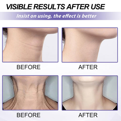 Neck Firming Cream,Strengthen Neck Cream,Neck Firming Cream Tightening Lifting Sagging Skin,Aging Skin & Saggy Skin,Anti Aging Neck Cream,Reduce Wrinkles & Smoothing Neck Fine LIines-Neck&Body
