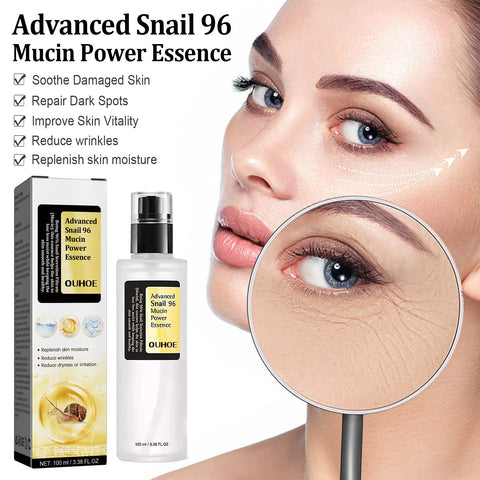 Grospe Advanced Snail 96 Mucin Power Essence Moisturiser, Hydrating Serum for Face with Snail Secretion Filtrate for Dull and Damaged Skin, Soothing Snail Mucin Serum for Skin Care 3.38 fl.oz