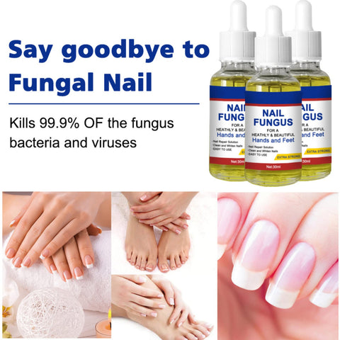 Nail Fungal Treatment, Toenail Treatment Extra Strong Nail Repair Set, Fingernail Toenail Care, Fix Renew Damaged, Broken, Anti Fungus Nail Repair (1PC)