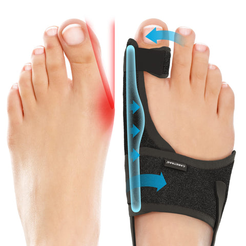 Caretras Bunion Corrector, Orthopedic Bunion Splint, Big Toe Separator Pain Relief, Non-Surgical Hallux Valgus Correction, Hammer Toe Straightener, Day Night Support (Simple Elegant (2 Count))
