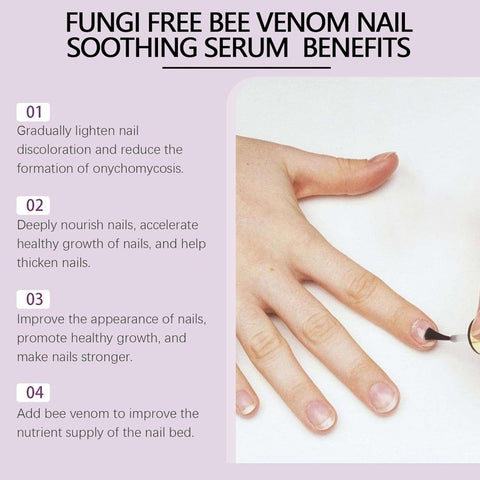 Flysmus Bee Venom Nail Treatment Serum,Natural Bee Venom Nail Serum,Ingrown Toenail Treatment Drop,Nail Growth and Repair Serum (1pcs)