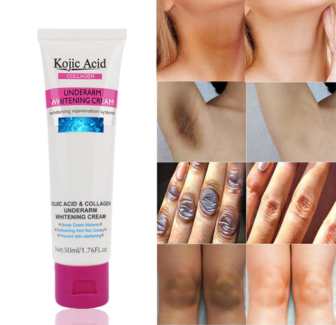 Kojic Acid Skin Whitening Cream for Intimate Area,Dark Spot Corrector for Body,Bleaching Cream for Private Area,Underarms,Knees,Elbows,Bikini Line,Armpit,Dark Spot Remover,1.7oz