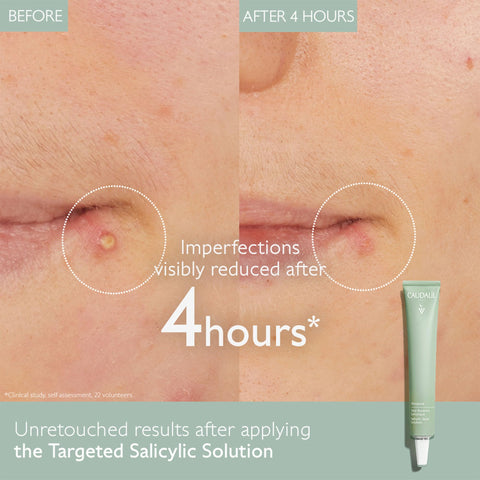 Caudalie Vinopure Color Correcting Spot Solution with Salicylic Acid