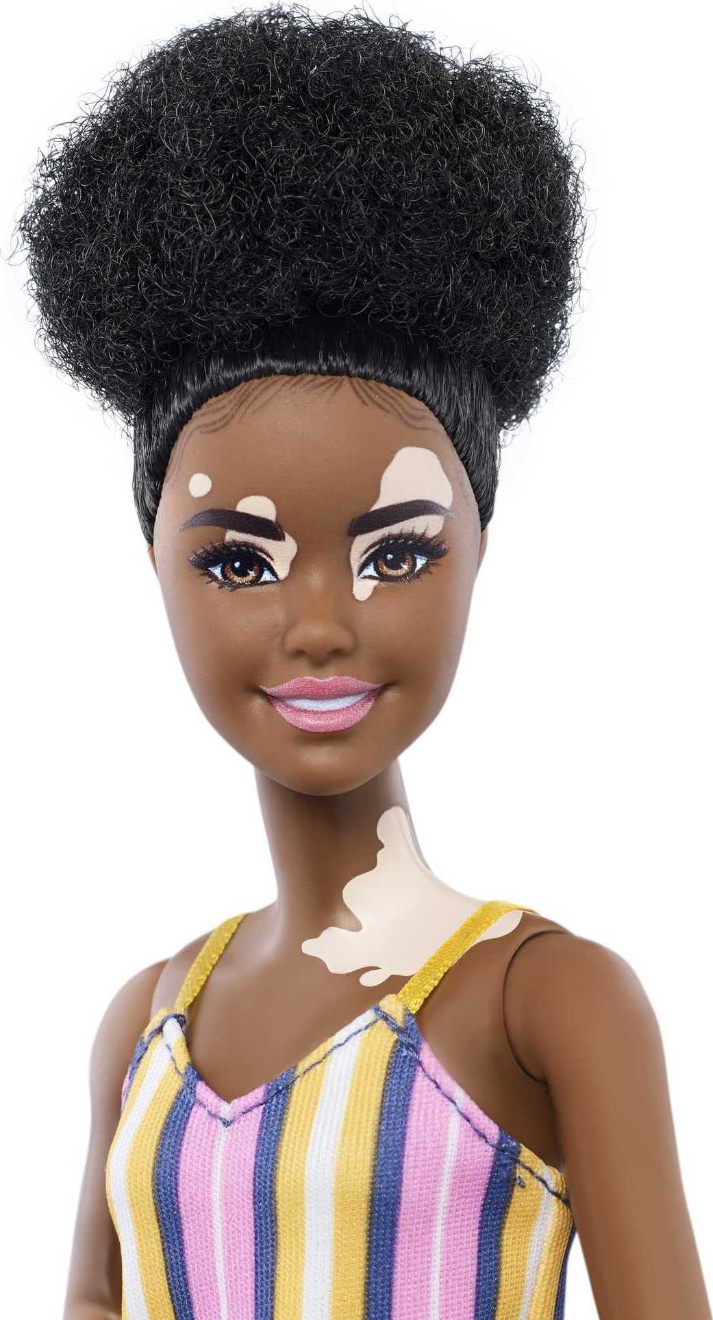Barbie Fashionistas Doll #135 with Natural Curly Hair & Vitiligo Wearing Striped Dress & Accessories Including Sneakers & Fanny Pack
