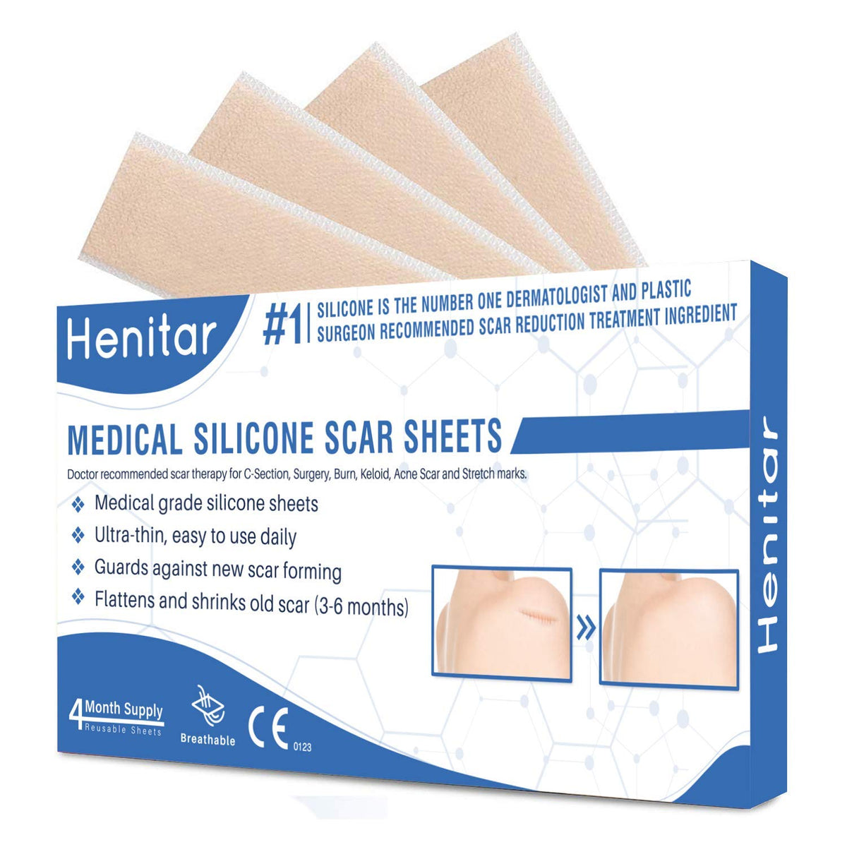 L'Oreal SUBLIME BRONZE Self-Tannning Mist, Medium Natural Tan 4.60 oz (Pack of 7)