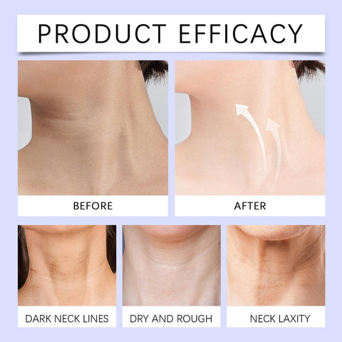 Tighten & Lift Firming Neck Cream,2PCS neck firming cream,Anti Aging neck cream for sagging and tighten,Lifting Sagging Skin & Smooth Neck Wrinkle,Hydrating Neck Cream,Skincare Neck Cream-50ml*2