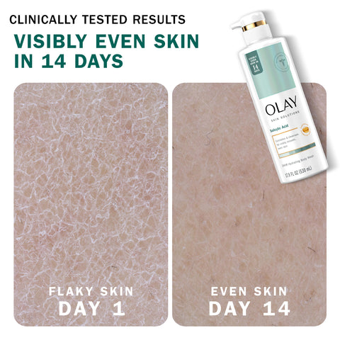 Olay Skin Solutions Hydrating Body Wash for Women with Salicylic Acid, 17.9 fl oz (Pack of 4)