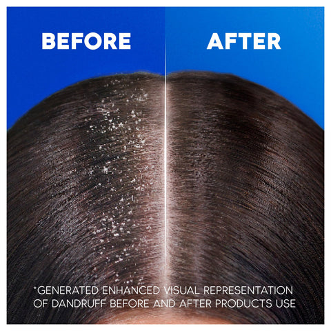 Head & Shoulders Classic Clean Anti Dandruff Shampoo, 3x400ml, Up to 100% Flake Free, Clinically Proven, For Any Hair and Scalp Type, For Daily use, Clean Feeling