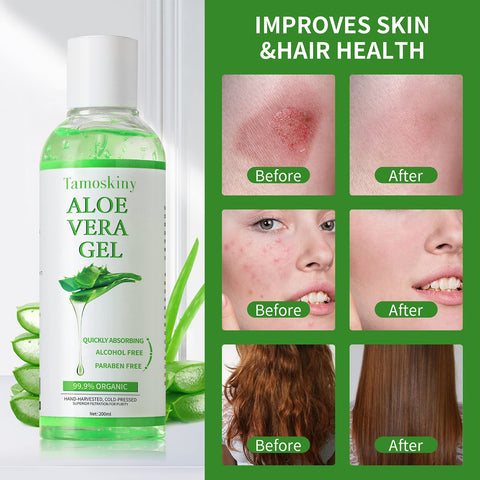 99.9% Organic Aloe Vera Gel for Face, Hair, Sunburn Relief, Pure Aloe Vera Soothing Gel for Skin Care, Acne, After Sun Repair, After Shave, No Sticky Residue, Moisturizing Quick Absorbing - 6.8 oz
