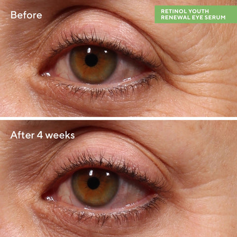 Murad Resurgence Retinol Youth Renewal Eye Serum - Anti-Aging Serum for Under Eye and Eyelids 15ml