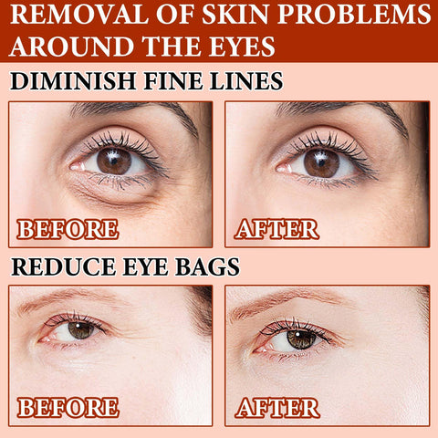 DuoZeng Eye Cream,Under Eye Cream for Fine Lines and Wrinkles,Dark Circle & Puffiness Reducer & Under Eye Bags,Moisturizing Lifting Eye Cream Under Eye Treatment for Women