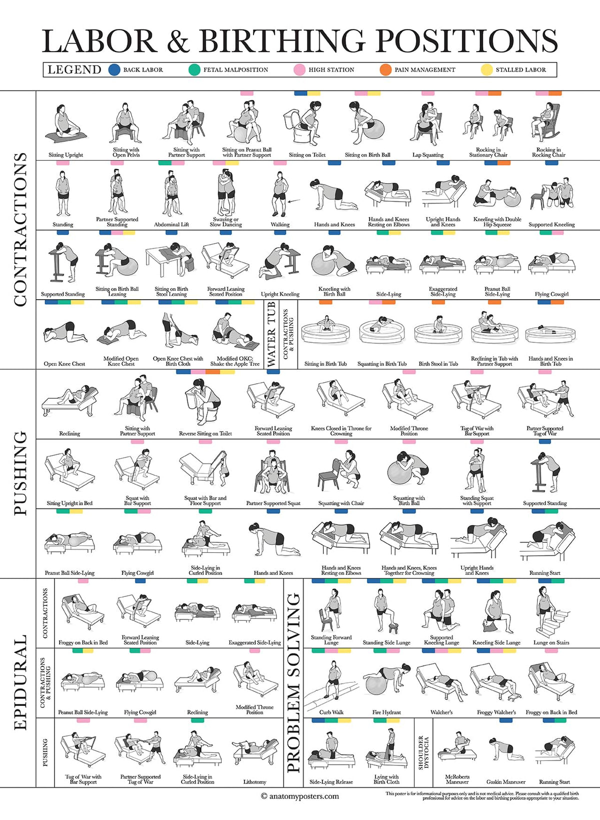 Labor Positions Poster - Birthing Positions Chart - Childbirth Education for Doula, Midwife or Birthworker - 18" x 24" - Laminated